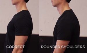 rounded-shoulders-posture