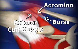 rauschpt.net | Shoulder Impingement